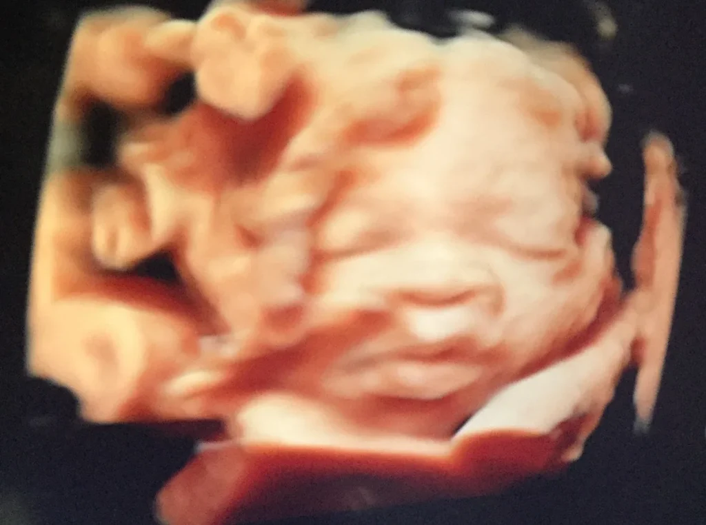 A 3D ultrasound image of LaSaaun during pregnancy, with all medical screen information removed.